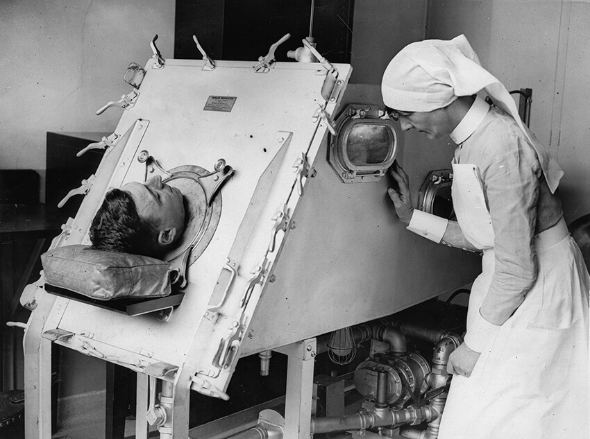 An iron lung helps a patient breath at St. Bartholomews Hospital in London, 1935.